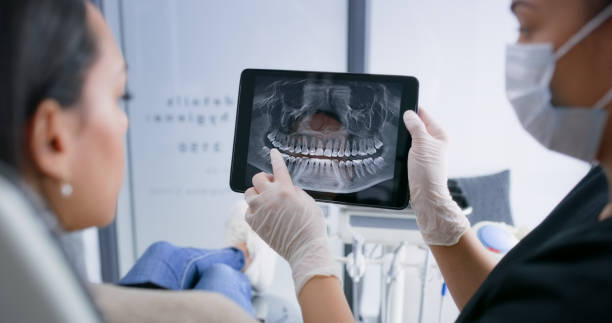 Licensed Tooth Extraction service in Souderton, PA - Smile Center Dentistry